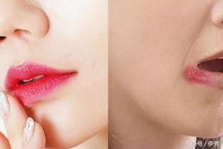 吃瓜嘴角裂口,揭秘过度吃瓜的危害